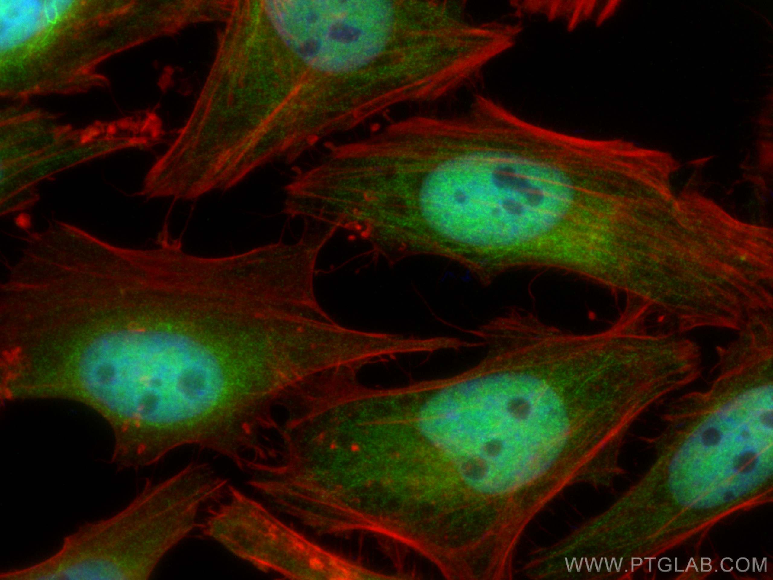 Immunofluorescence (IF) / fluorescent staining of HeLa cells using PSMD4 Monoclonal antibody (66179-1-Ig)