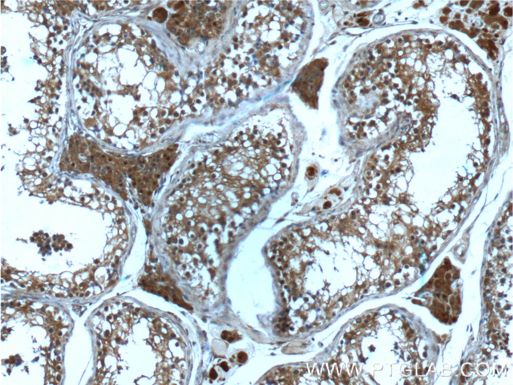 Immunohistochemistry (IHC) staining of human testis tissue using PSMD4 Monoclonal antibody (66179-1-Ig)