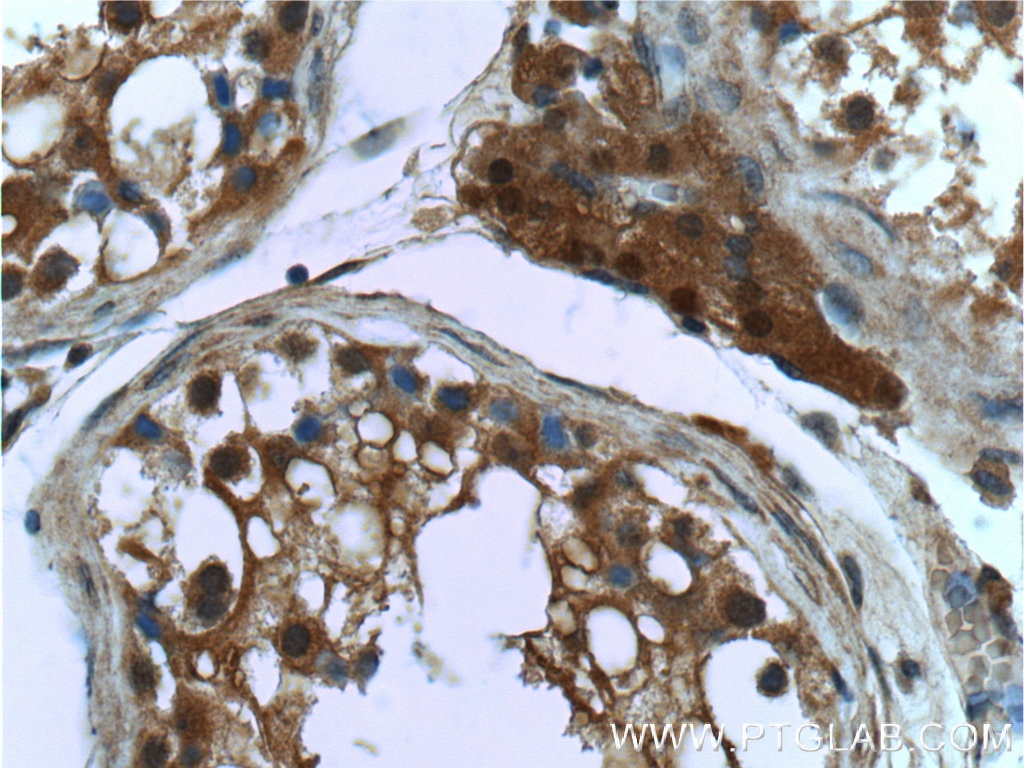 Immunohistochemistry (IHC) staining of human testis tissue using PSMD4 Monoclonal antibody (66179-1-Ig)