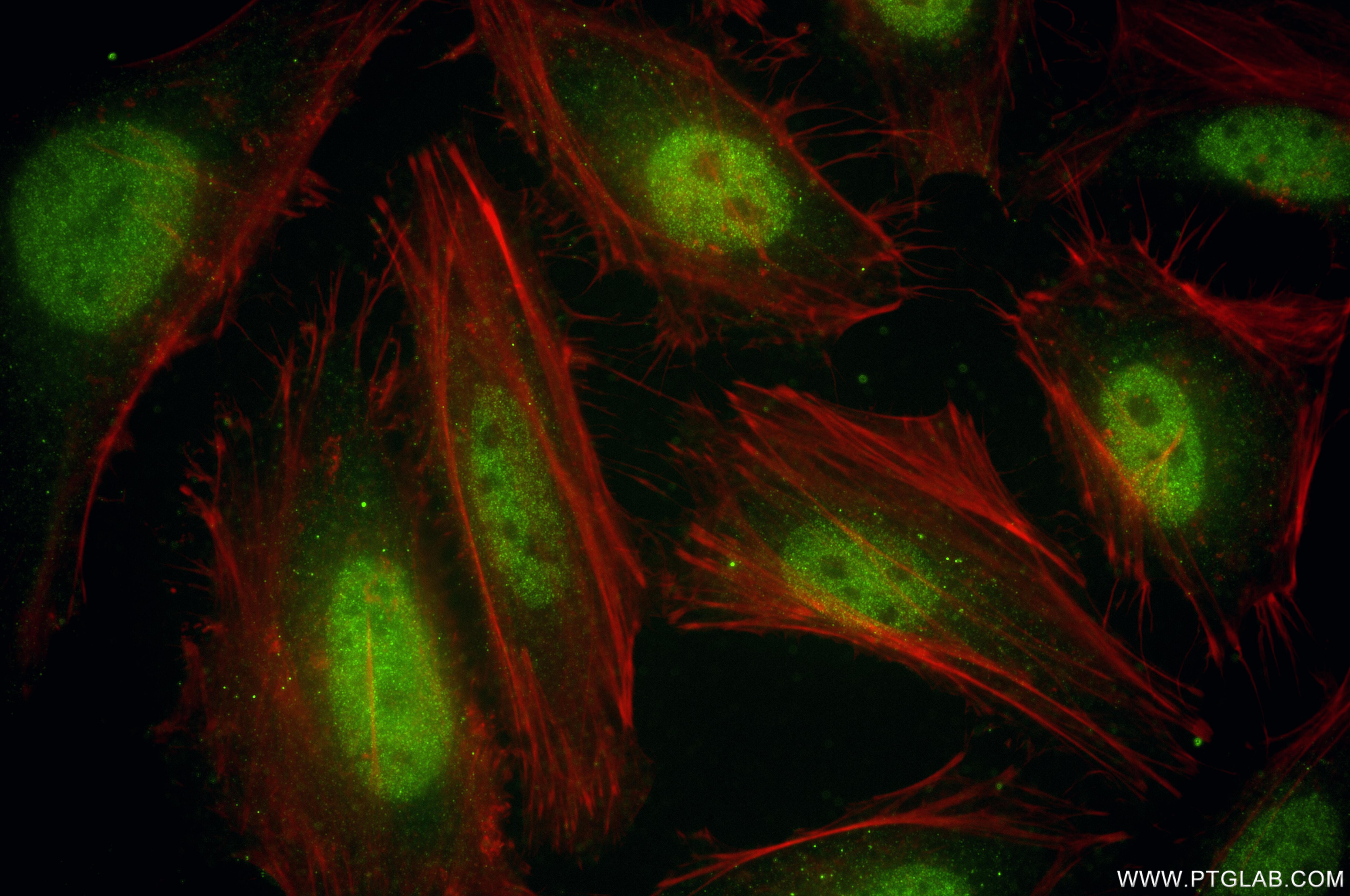 Immunofluorescence (IF) / fluorescent staining of HeLa cells using PSMD4 Recombinant antibody (86558-1-RR)
