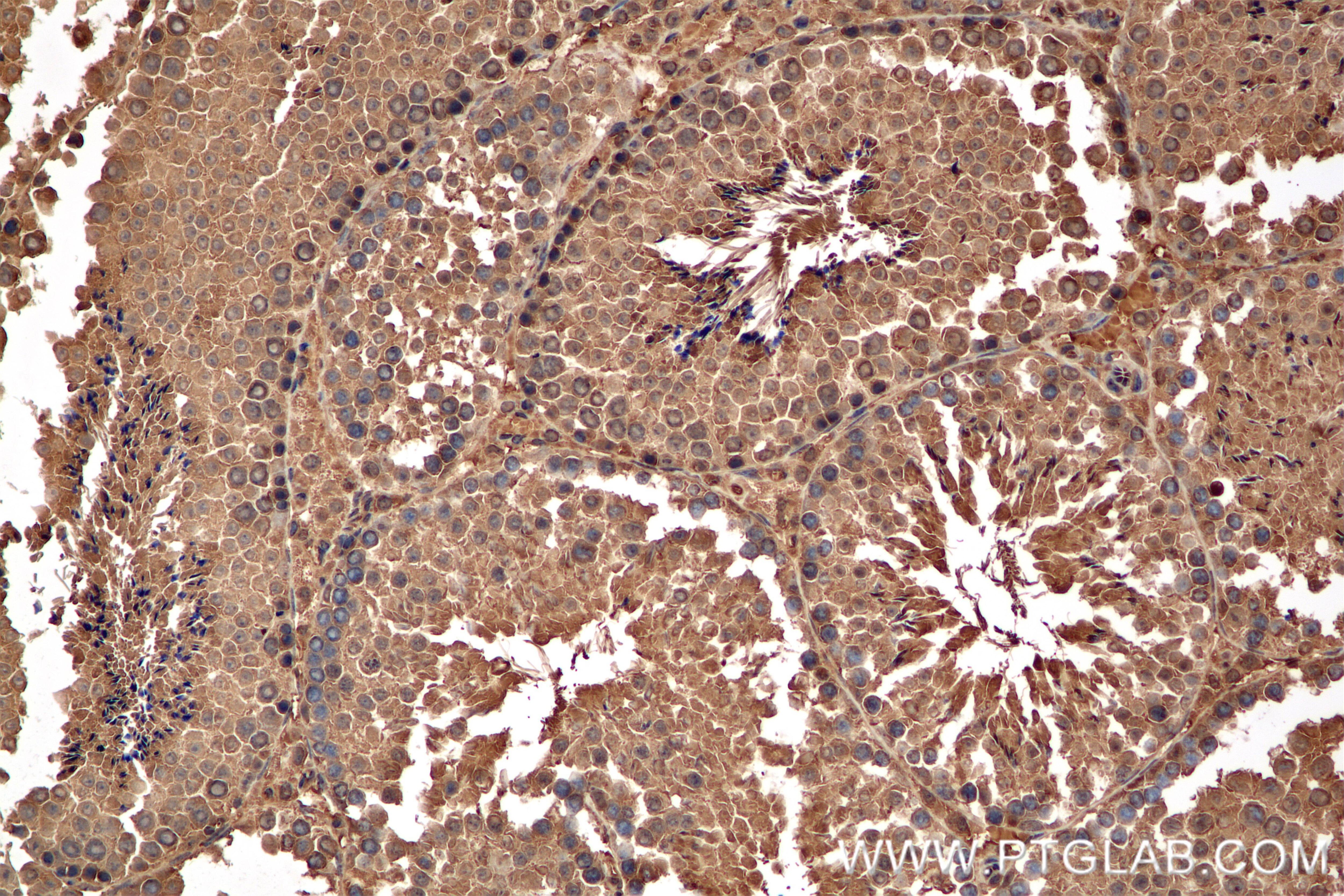 Immunohistochemistry (IHC) staining of mouse testis tissue using PSMD4 Recombinant monoclonal antibody (86558-1-RR)