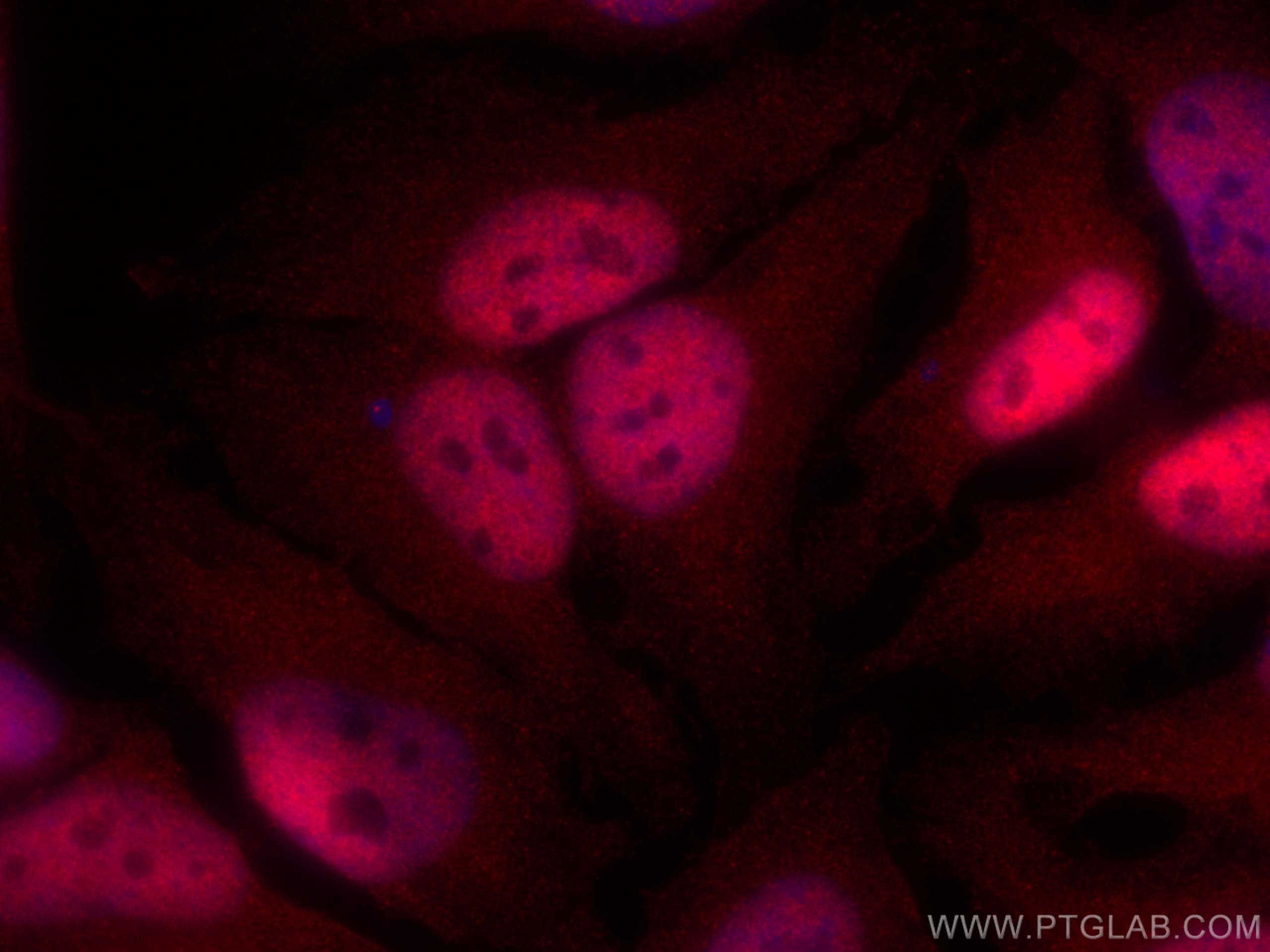 Immunofluorescence (IF) / fluorescent staining of HeLa cells using CoraLite®594-conjugated PSMD4 Monoclonal antibody (CL594-66179)