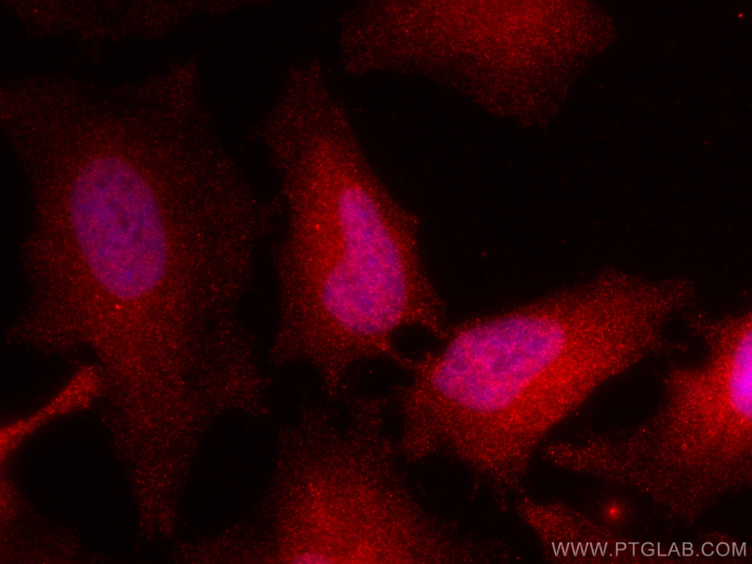 Immunofluorescence (IF) / fluorescent staining of HeLa cells using CoraLite®594-conjugated PSMD4 Monoclonal antibody (CL594-66179)