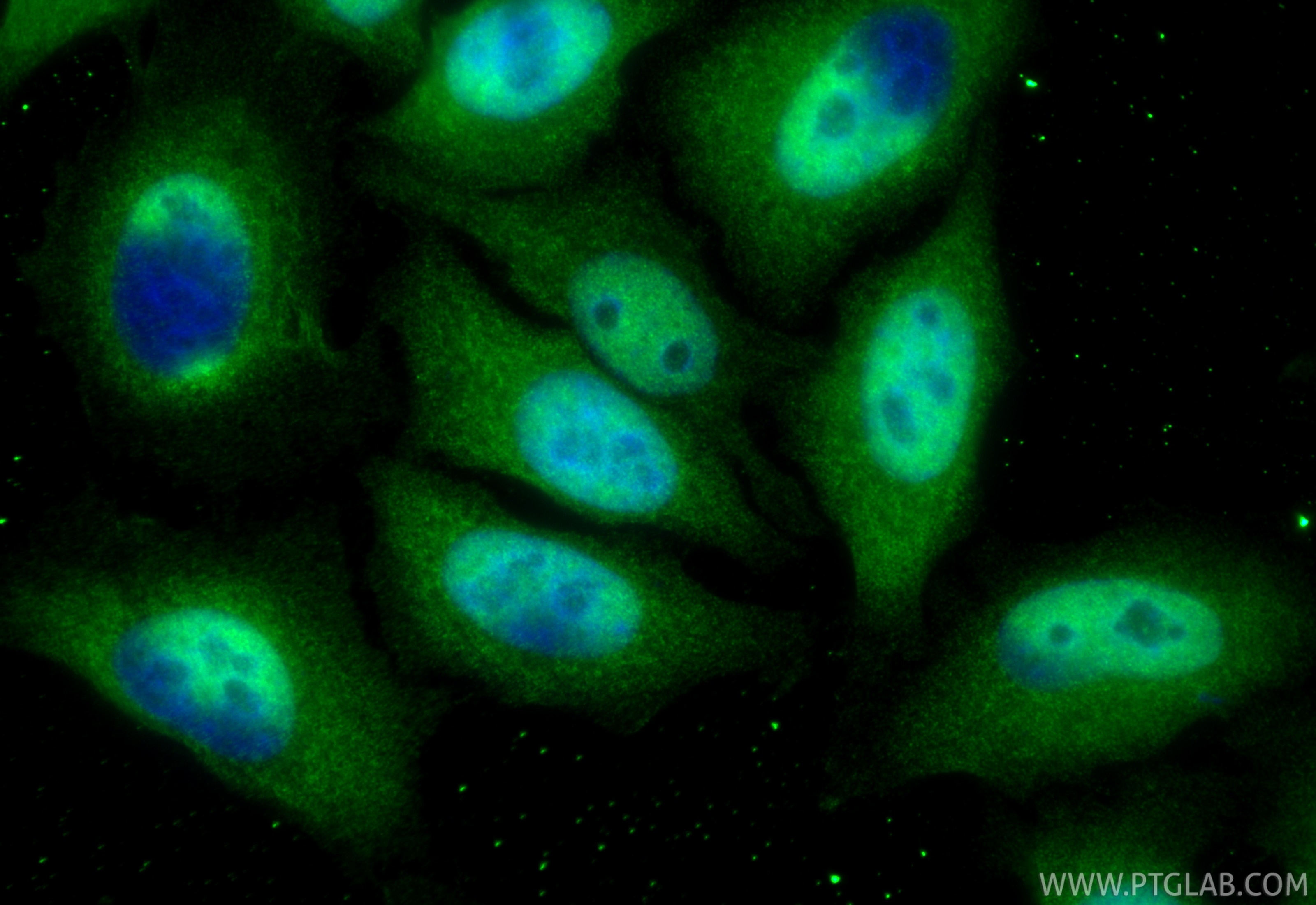 IF Staining of HepG2 using RMX00058 Immunofluorescence (IF) / fluorescent staining of HepG2 cells using Multi-rAb® PSMD4 Multi-Recombinant antibody (RMX00058)