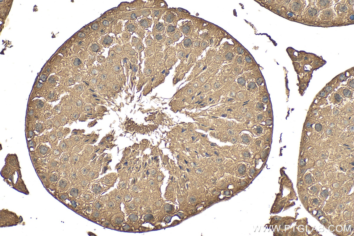 IHC staining of mouse testis using RMX00058 Immunohistochemistry (IHC) staining of mouse testis tissue using Multi-rAb® PSMD4 Multi-Recombinant antibody (RMX00058)