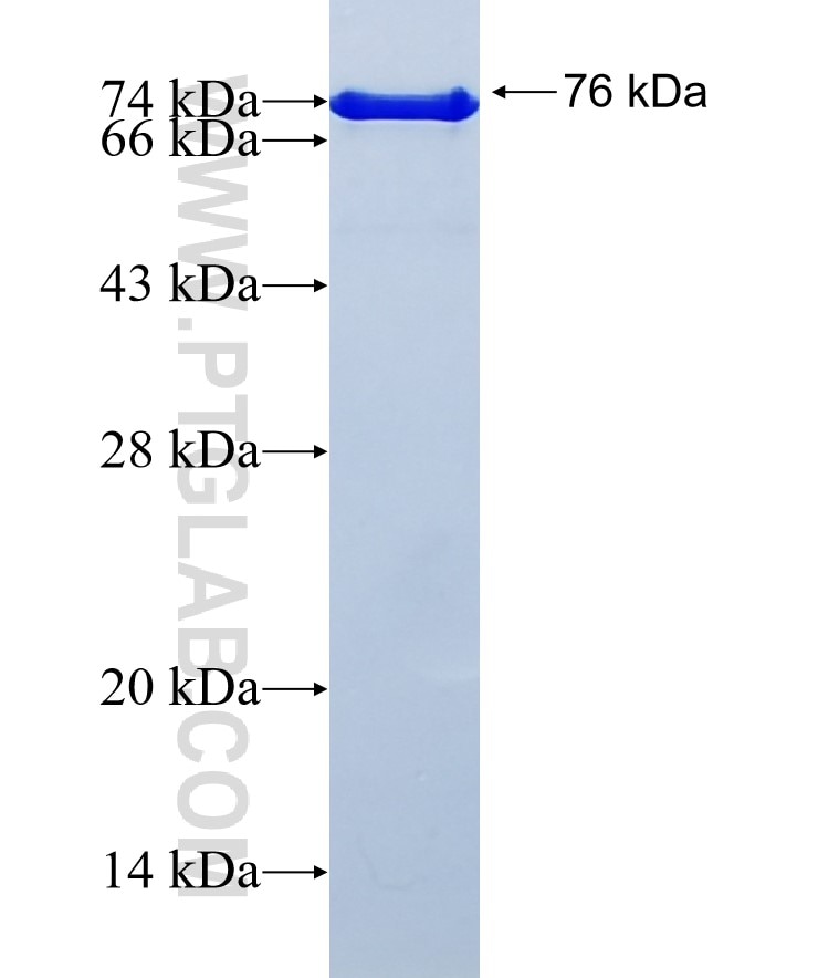 PSMD4 fusion protein Ag6691 SDS-PAGE
