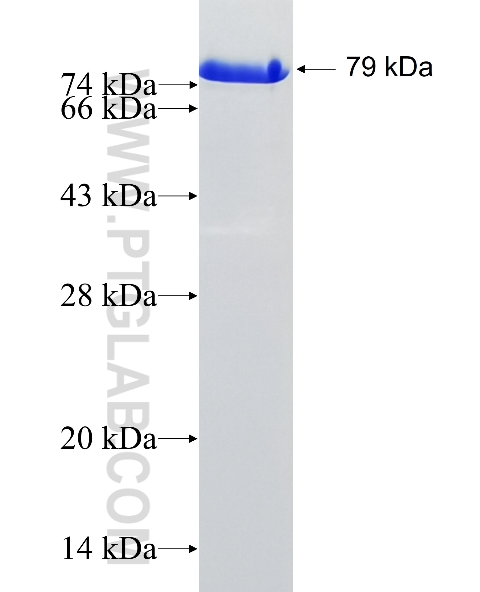 PSMD4 fusion protein Ag6691 SDS-PAGE