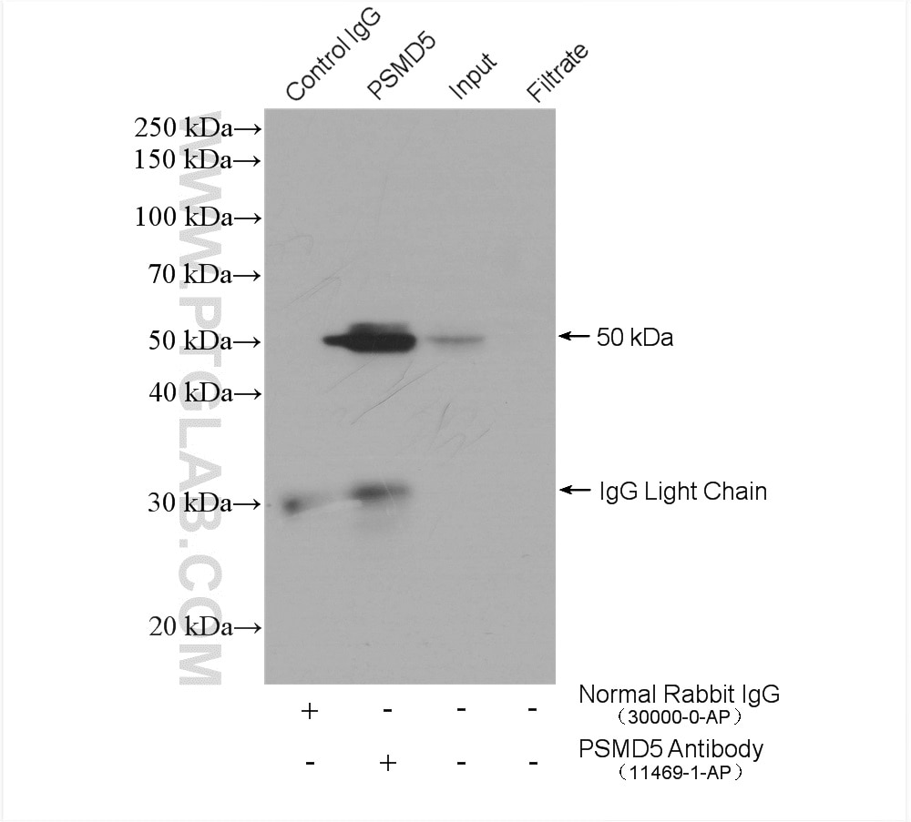 IP experiment of mouse liver using 11469-1-AP