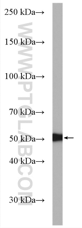 Western Blot (WB) analysis of HeLa cells using PSMD5 Polyclonal antibody (11469-1-AP)