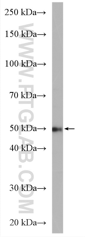 Western Blot (WB) analysis of Jurkat cells using PSMD5 Polyclonal antibody (11469-1-AP)