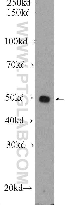 Western Blot (WB) analysis of mouse liver tissue using PSMD5 Polyclonal antibody (11469-1-AP)