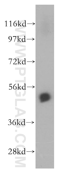 Western Blot (WB) analysis of human liver tissue using PSMD5 Polyclonal antibody (11469-1-AP)