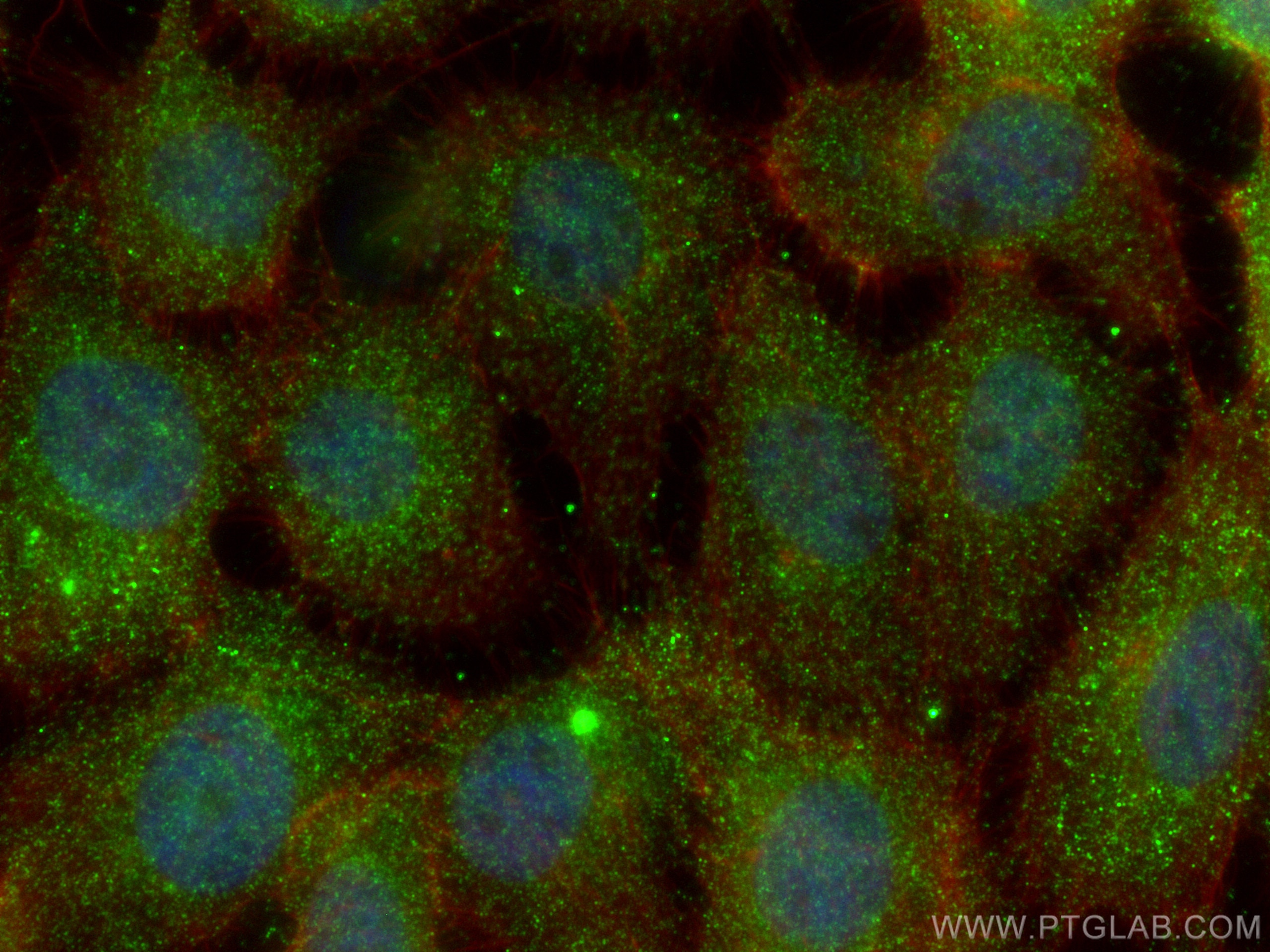 Immunofluorescence (IF) / fluorescent staining of A431 cells using PSMD5 Monoclonal antibody (67682-1-Ig)