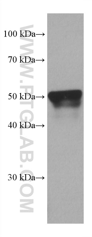 Western Blot (WB) analysis of pig liver tissue using PSMD5 Monoclonal antibody (67682-1-Ig)