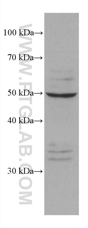 Western Blot (WB) analysis of K-562 cells using PSMD5 Monoclonal antibody (67682-1-Ig)