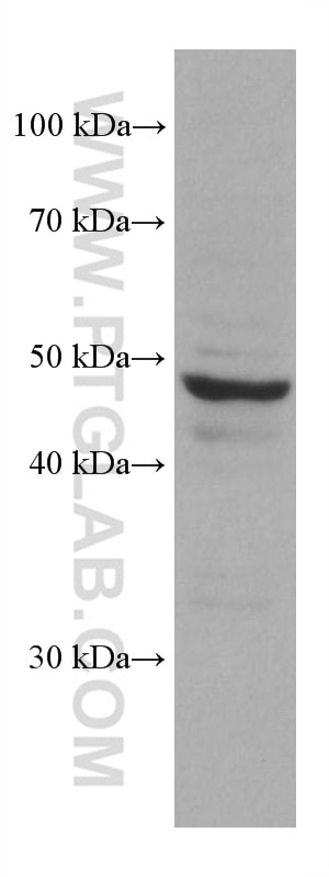 Western Blot (WB) analysis of HCT 116 cells using PSMD5 Monoclonal antibody (67682-1-Ig)