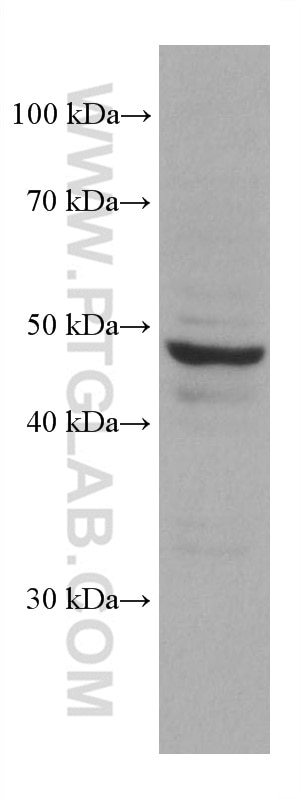 WB analysis of HCT 116 using 67682-1-Ig