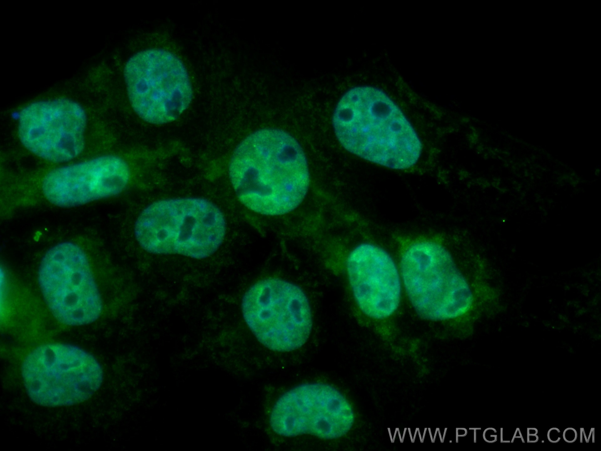 Immunofluorescence (IF) / fluorescent staining of A431 cells using CoraLite® Plus 488-conjugated PSMD5 Monoclonal ant (CL488-67682)