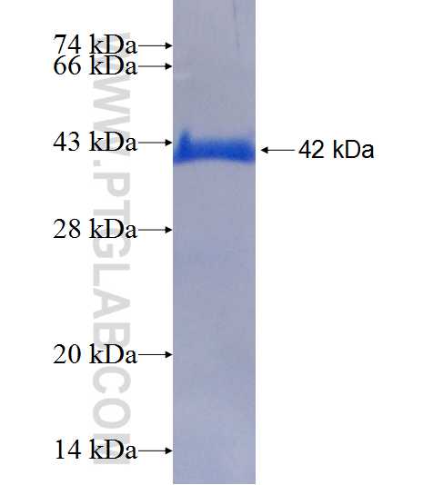 PSMD5 fusion protein Ag19298 SDS-PAGE