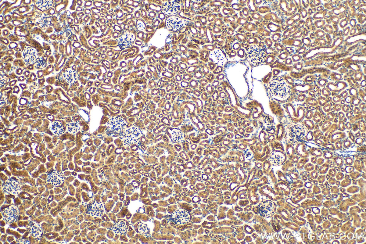 Immunohistochemistry (IHC) staining of mouse kidney tissue using PSMD6 Polyclonal antibody (12539-1-AP)