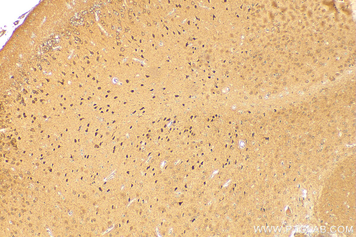 Immunohistochemistry (IHC) staining of mouse brain tissue using PSMD6 Polyclonal antibody (12539-1-AP)