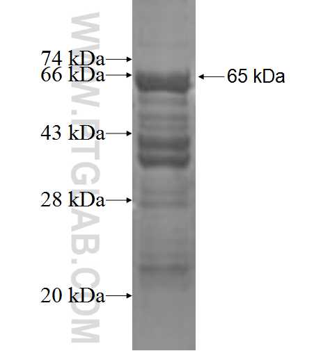PSMD6 fusion protein Ag3251 SDS-PAGE