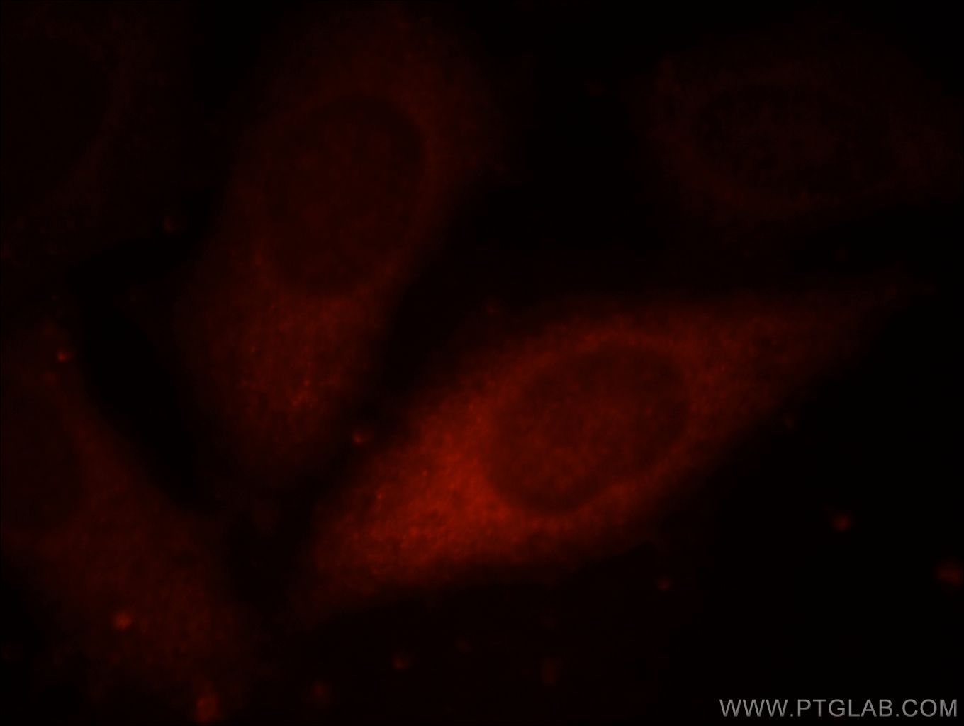 Immunofluorescence (IF) / fluorescent staining of HepG2 cells using PSMD7 Polyclonal antibody (16034-1-AP)