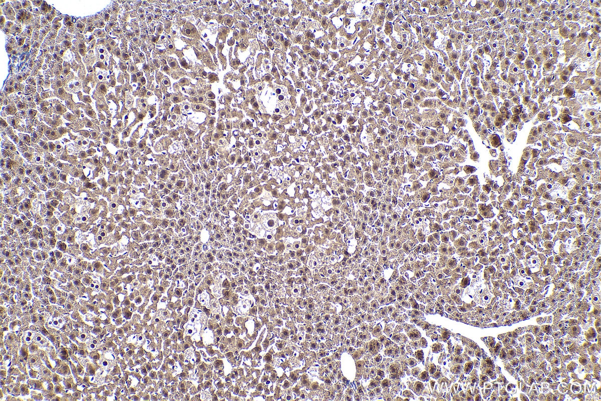 Immunohistochemistry (IHC) staining of mouse liver tissue using PSMD7 Polyclonal antibody (16034-1-AP)