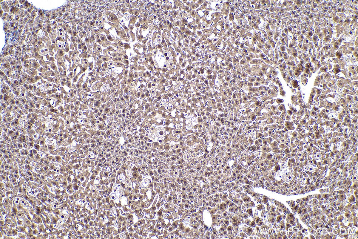 IHC staining of mouse liver using 16034-1-AP