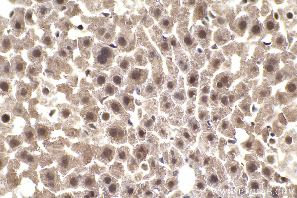 IHC staining of mouse liver using 16034-1-AP