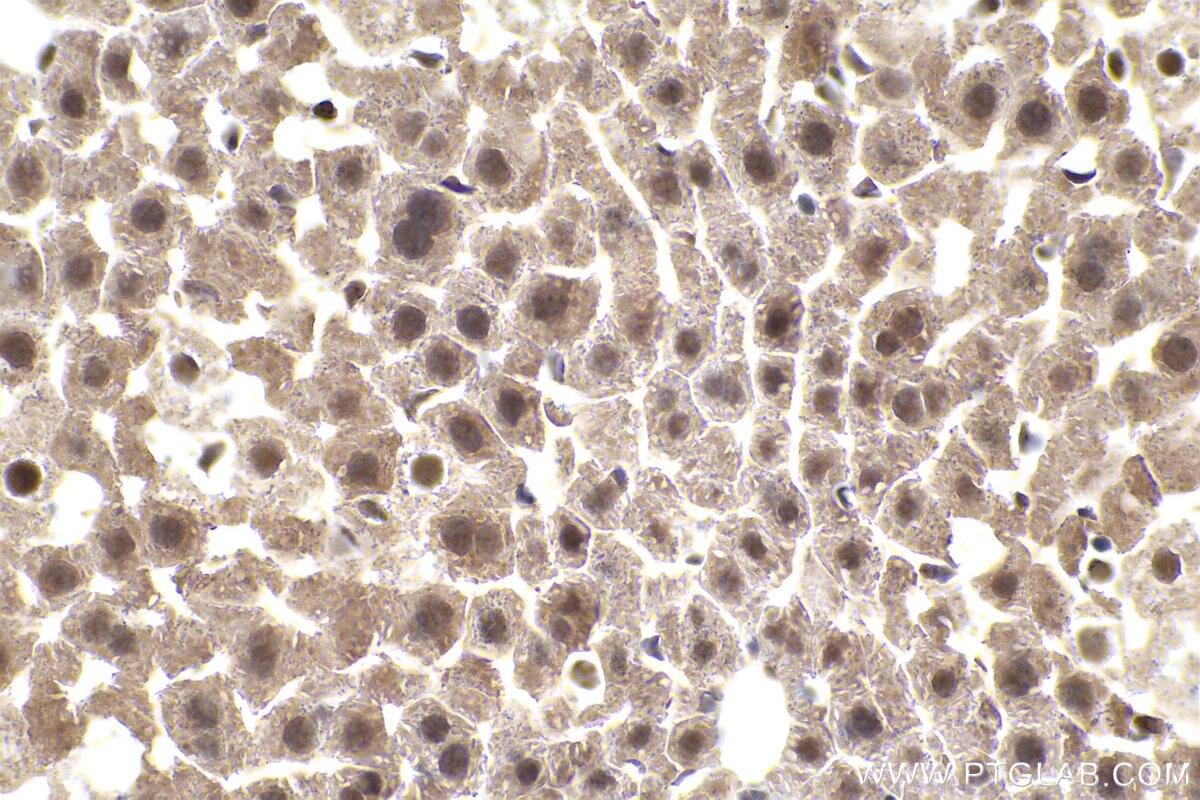 Immunohistochemistry (IHC) staining of mouse liver tissue using PSMD7 Polyclonal antibody (16034-1-AP)