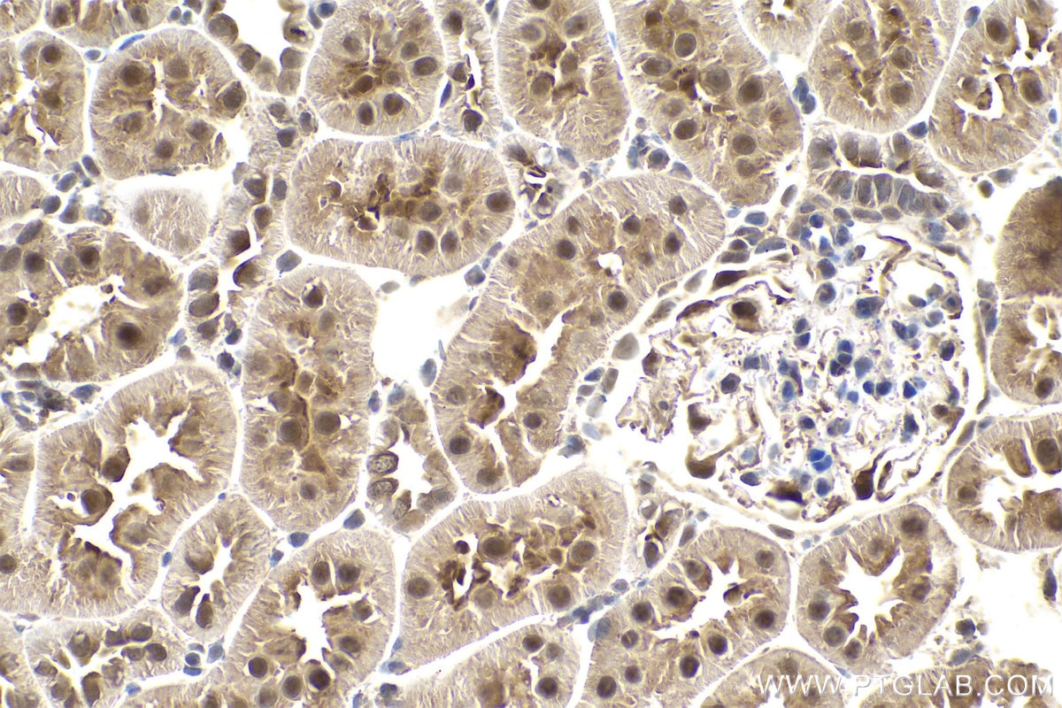 Immunohistochemistry (IHC) staining of rat kidney tissue using PSMD7 Polyclonal antibody (16034-1-AP)
