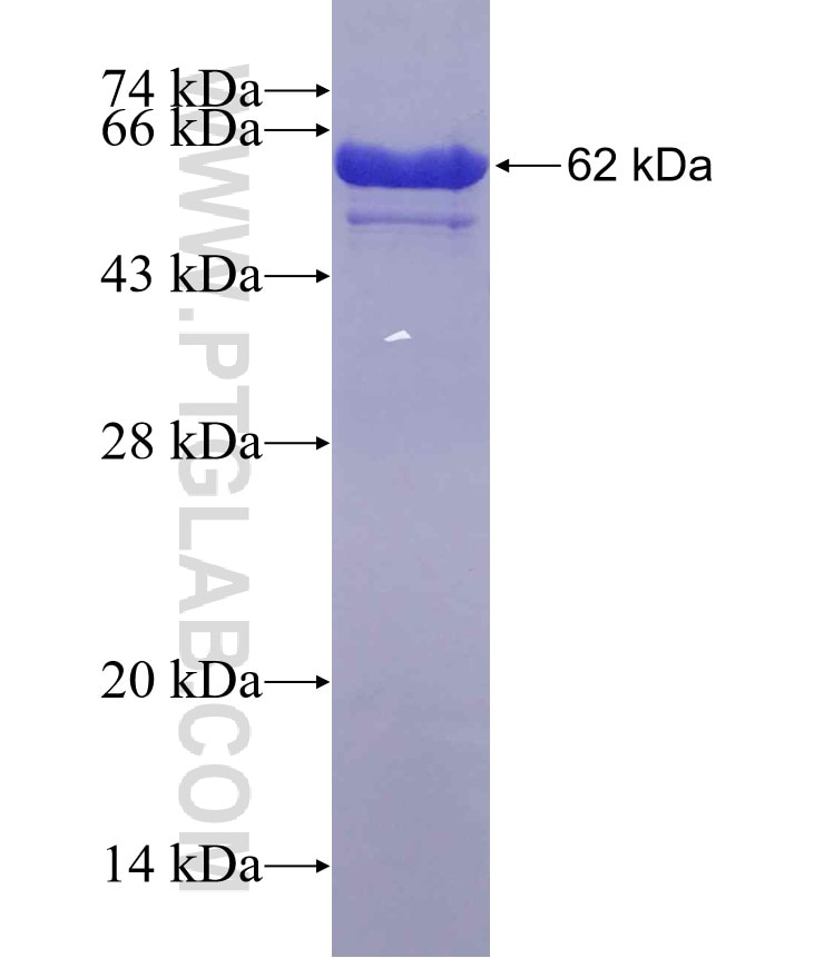 PSMD7 fusion protein Ag8905 SDS-PAGE