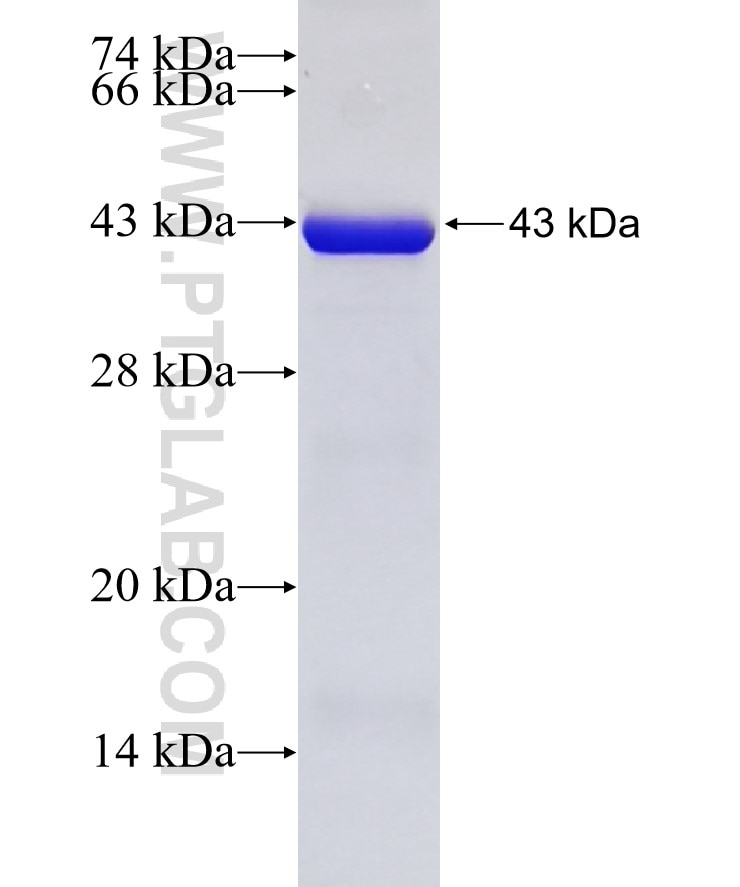 PSMD7 fusion protein Ag9305 SDS-PAGE