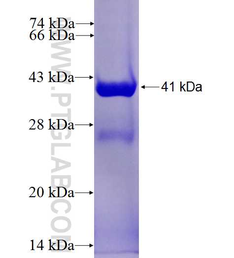 PSMD8 fusion protein Ag26567 SDS-PAGE