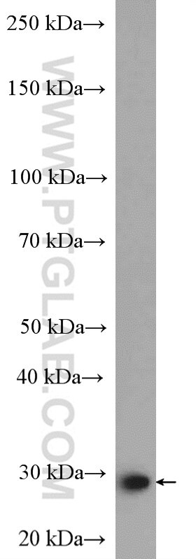 Western Blot (WB) analysis of mouse spleen tissue using PSMD9 Polyclonal antibody (26922-1-AP)