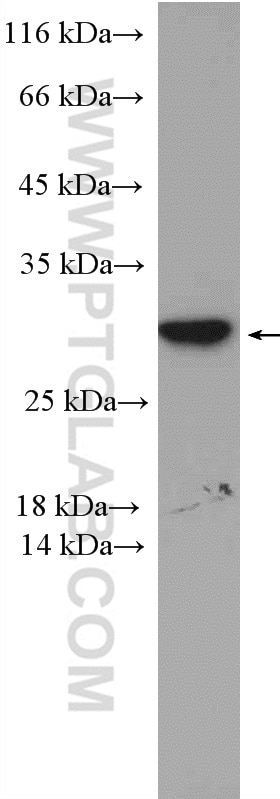 WB analysis of MCF-7 using 26922-1-AP