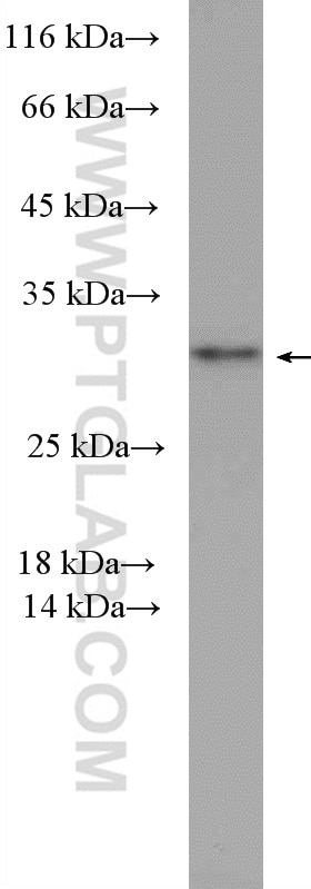 Western Blot (WB) analysis of MDA-MB-453s cells using PSMD9 Polyclonal antibody (26922-1-AP)