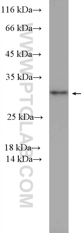 WB analysis of MDA-MB-453s using 26922-1-AP