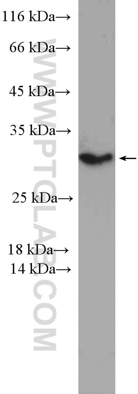 Western Blot (WB) analysis of Jurkat cells using PSMD9 Polyclonal antibody (26922-1-AP)
