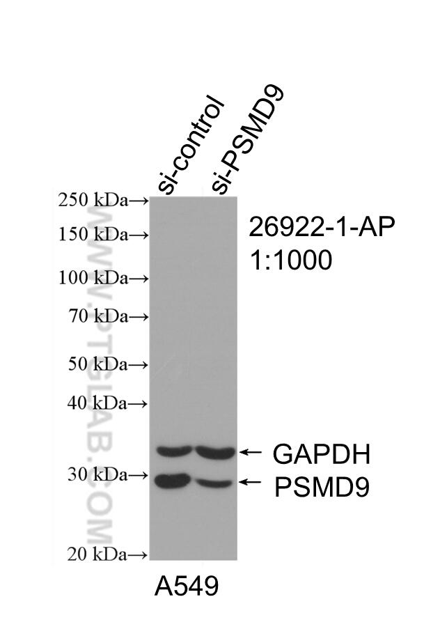 Western Blot (WB) analysis of A549 cells using PSMD9 Polyclonal antibody (26922-1-AP)