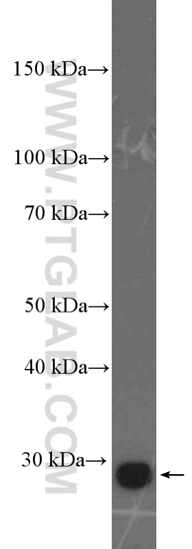 Western Blot (WB) analysis of A549 cells using PSMD9 Polyclonal antibody (26922-1-AP)