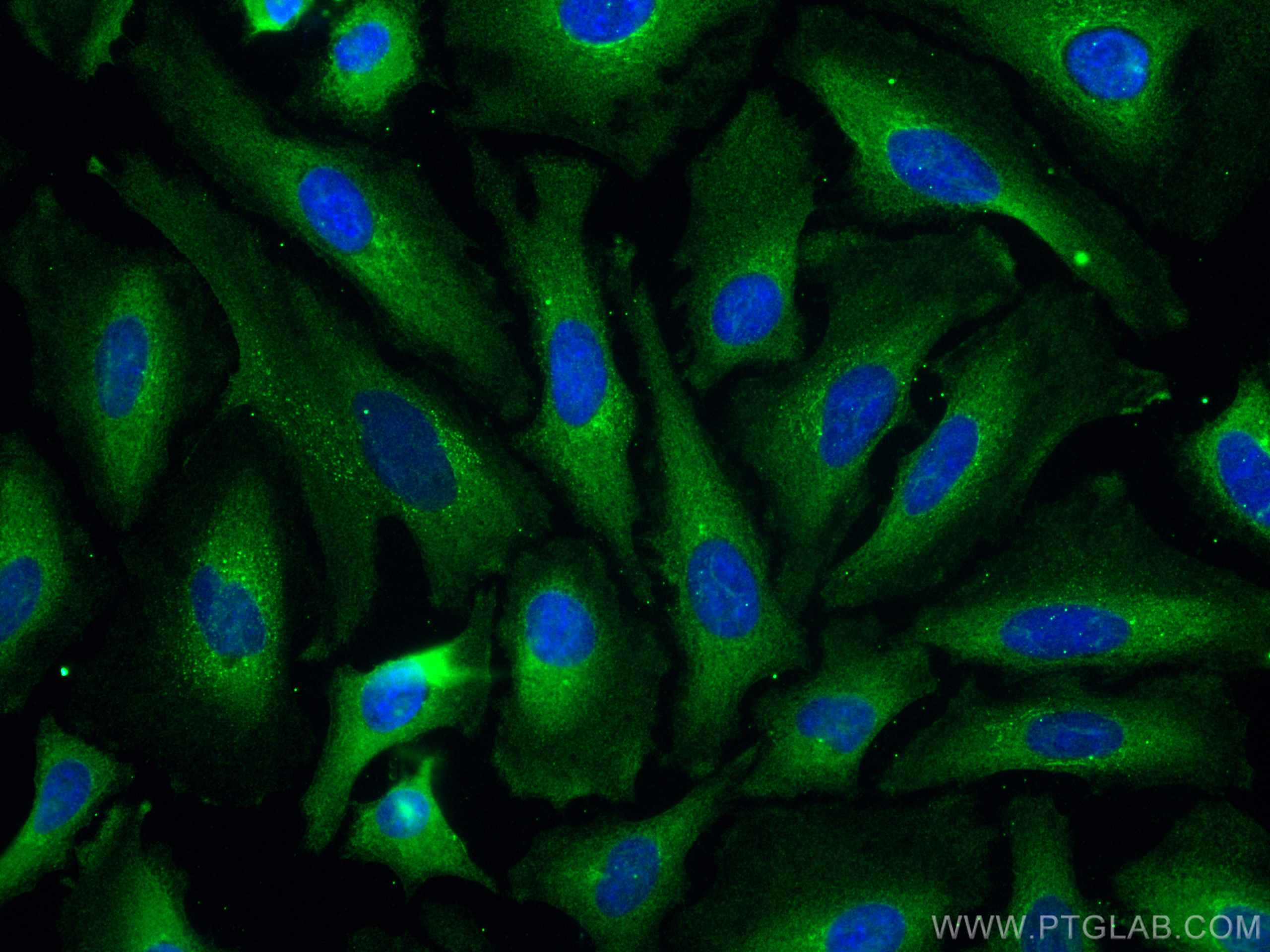 Immunofluorescence (IF) / fluorescent staining of HeLa cells using PSMD9 Monoclonal antibody (67338-1-Ig)