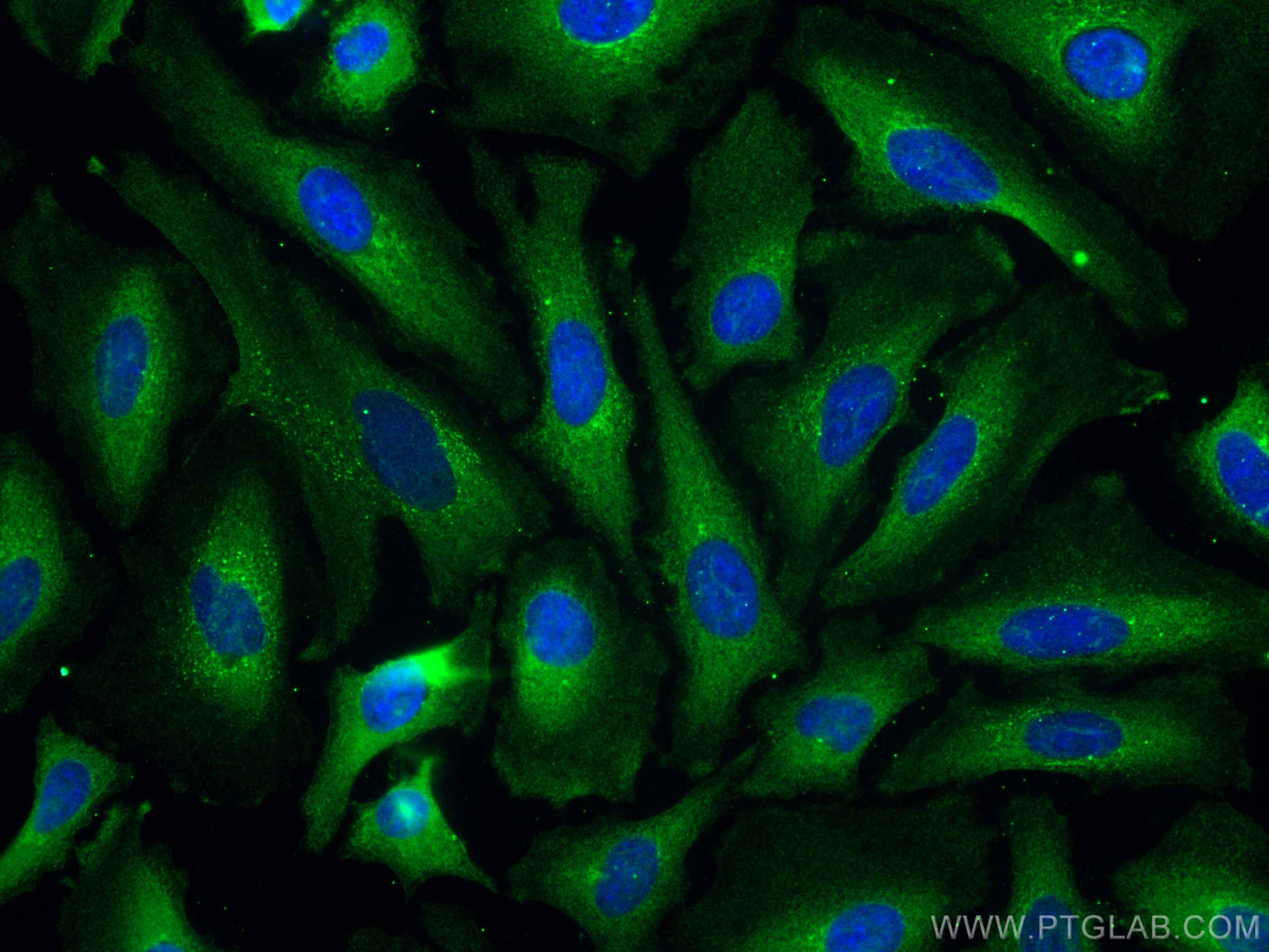 IF Staining of HeLa using 67338-1-Ig