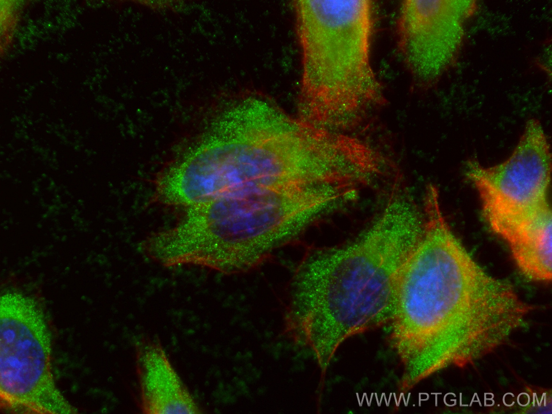 Immunofluorescence (IF) / fluorescent staining of U2OS cells using PSMD9 Monoclonal antibody (67338-1-Ig)