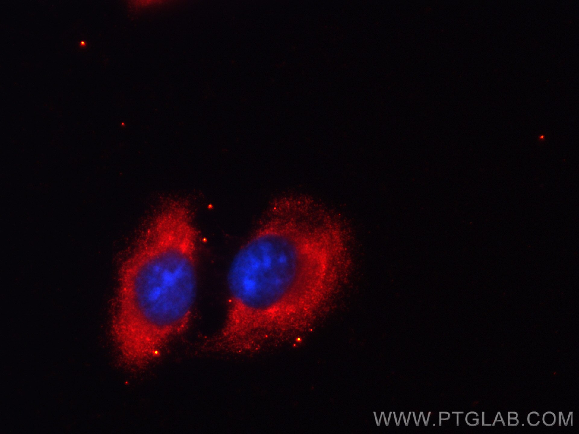 Immunofluorescence (IF) / fluorescent staining of U2OS cells using CoraLite®594-conjugated PSMD9 Monoclonal antibody (CL594-67338)