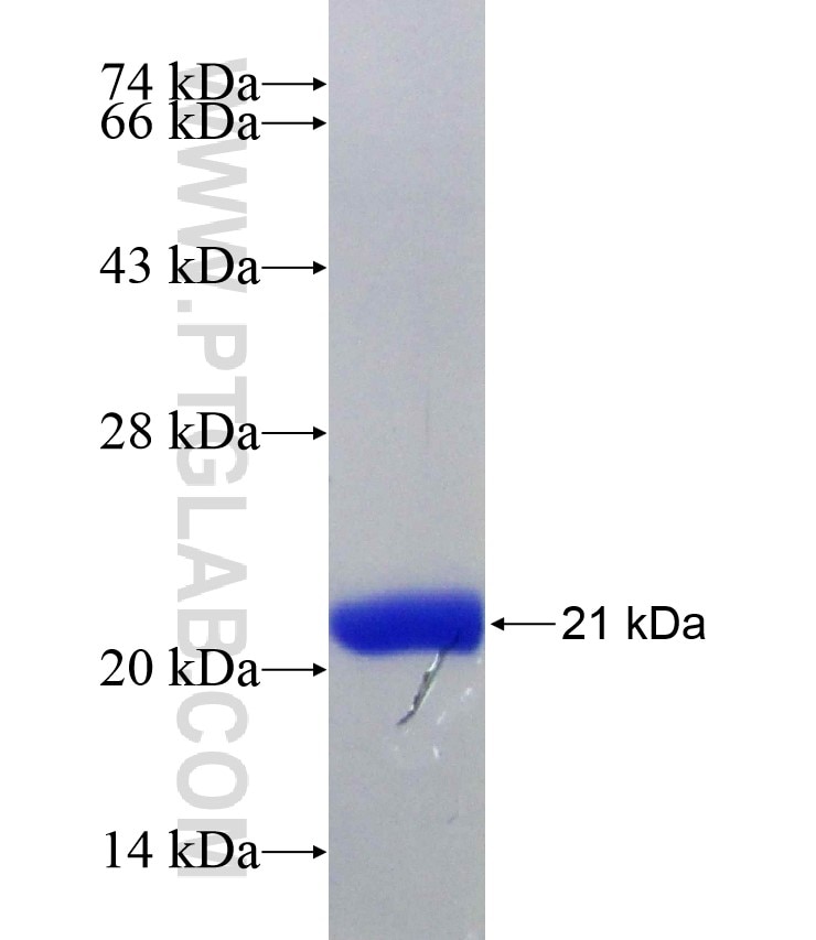 PSMD9 fusion protein Ag25654 SDS-PAGE
