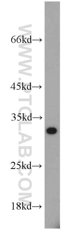 WB analysis of mouse spleen using 10543-1-AP