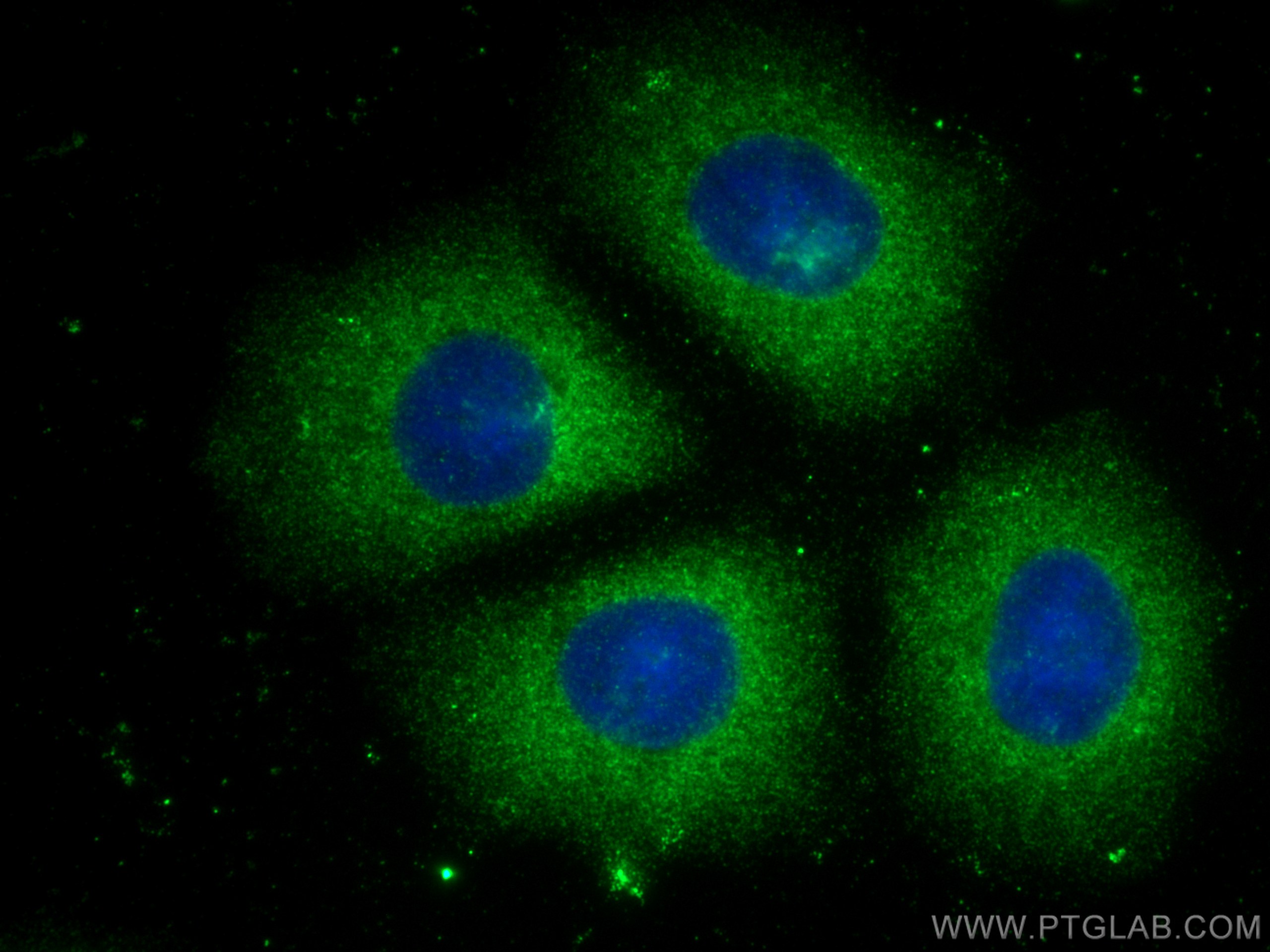 Immunofluorescence (IF) / fluorescent staining of MCF-7 cells using PSME1 Monoclonal antibody (67928-1-Ig)