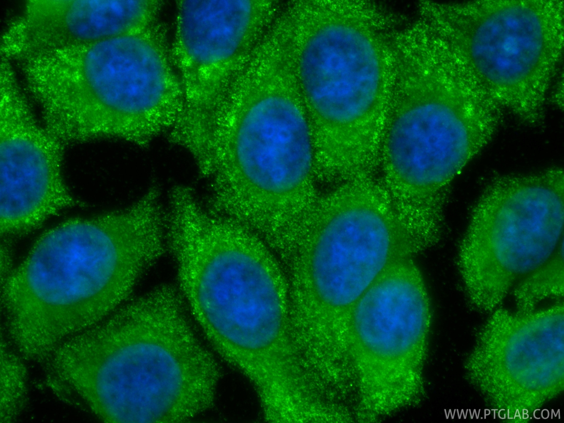 IF Staining of MCF-7 using 67928-1-Ig Immunofluorescence (IF) / fluorescent staining of MCF-7 cells using PSME1 Monoclonal antibody (67928-1-Ig)